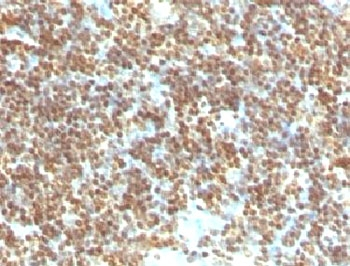 dsDNA Antibody