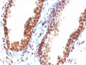 dsDNA Antibody
