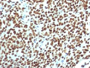 Nuclear Antigen Antibody