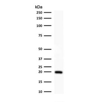 Ferritin Antibody (light chain specific)