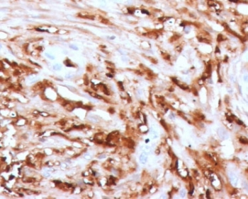 Ferritin Antibody (light chain specific)