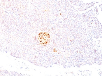 NSE Antibody