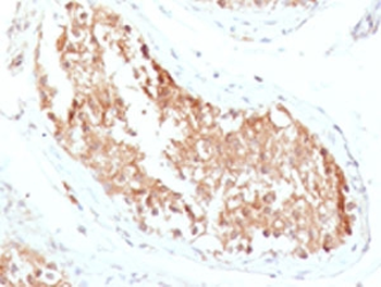 ALDH1A1 Antibody / Acetaldehyde dehydrogenase 1