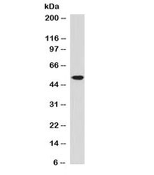 ALDH1A1 Antibody / Acetaldehyde dehydrogenase 1