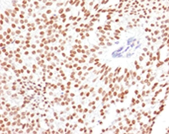 FOXA1 Antibody