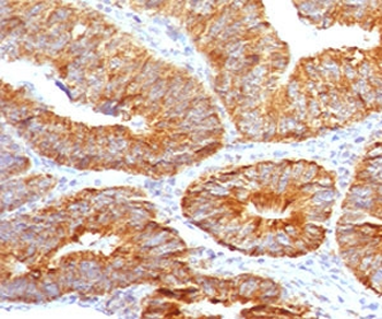 TL1A Antibody / VEGI / TNFSF15