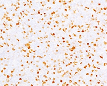 Topoisomerase II alpha Antibody / TOP2A