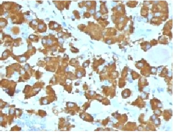 Growth Hormone Antibody (pituitary)