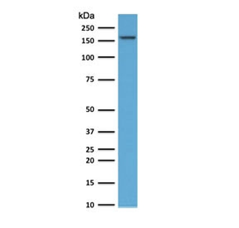 TOP2A Antibody / Topoisomerase II alpha