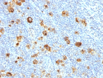 Recombinant CD15 Antibody