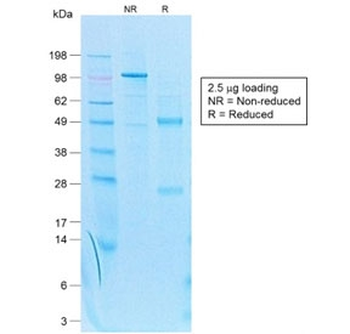 Recombinant Cytokeratin 7 Antibody / Rabbit Monoclonal