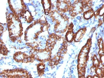Cadherin 16 Antibody