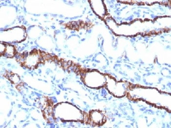 Cadherin 16 Antibody
