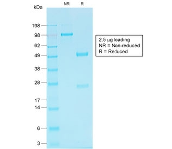 Cadherin 16 Antibody