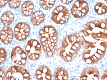 Recombinant EpCAM Antibody / Rabbit Monoclonal