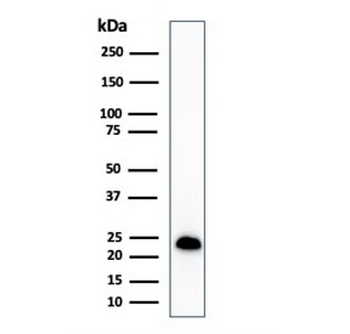 MART-1 / Melan-A Antibody