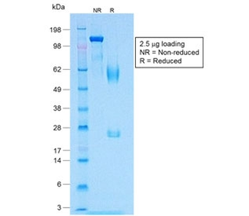 Recombinant MART-1 Antibody / Rabbit Monoclonal
