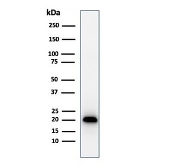 Recombinant Melan-A Antibody / Rabbit Monoclonal