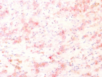 Recombinant TYRP1 Antibody / Tyrosinase Related Protein 1 / TRP1