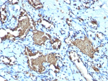 Recombinant Glycophorin A Antibody / Rabbit Monoclonal