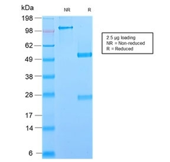 Recombinant Glycoprotein 2 Antibody / GP2 / ZAP75