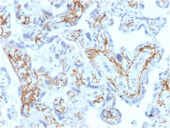 GSTM1 Antibody