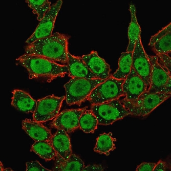 APE1 Antibody / APEX1