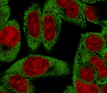 RPSA Antibody / 40S Ribosomal protein SA
