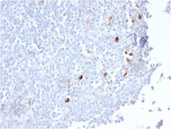 Recombinant IgM Antibody