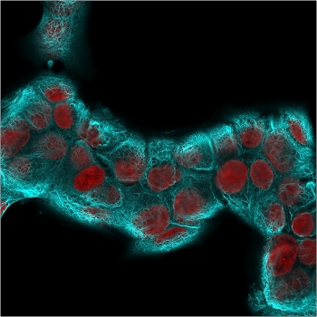 Recombinant Cytokeratin 18 Antibody