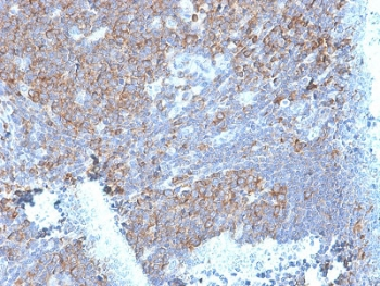 RPSA Antibody / 40S Ribosomal protein SA