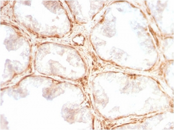 Galectin 1 Antibody / LGALS1