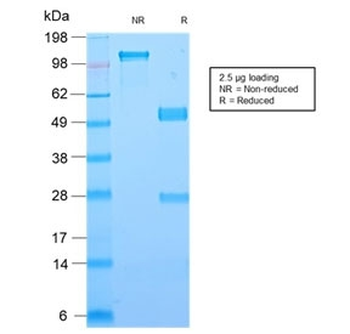 Galectin 1 Antibody / LGALS1