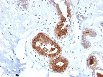 Recombinant Mammaglobin Antibody / SCGB2A2
