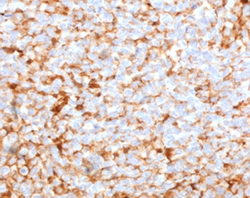 Recombinant Mammaglobin A Antibody / SCGB2A2