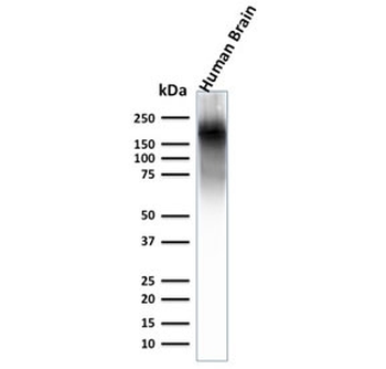 Neurofilament Antibody (-Heavy) / NF-H / NEFH