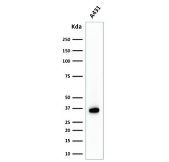 Nucleophosmin Antibody / NPM1