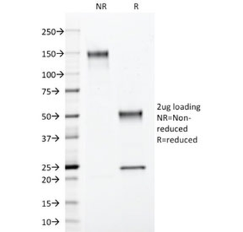 Progesterone Receptor Antibody