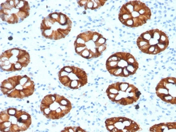 CK20 Antibody / Cytokeratin 20 / KRT20