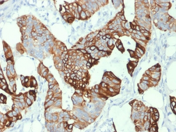 CK20 Antibody / Cytokeratin 20 / KRT20