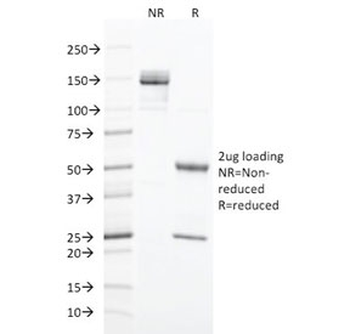 CK20 Antibody / Cytokeratin 20 / KRT20