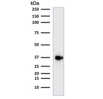 BOB1 Antibody