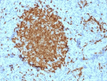 BOB1 Antibody