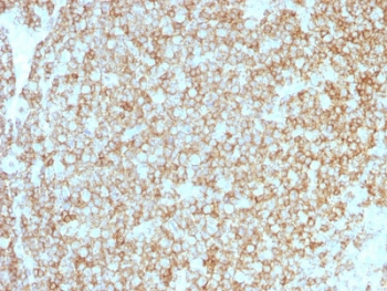 Recombinant CD45 Antibody Cocktail
