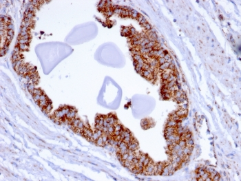 TMEPAI Antibody / PMEPA1