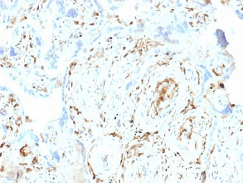 S100A2 Antibody