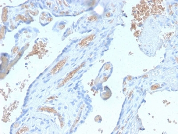 Recombinant Spectrin alpha 1 Antibody / SPTA1