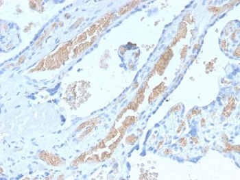 Recombinant Spectrin alpha 1 Antibody / SPTA1
