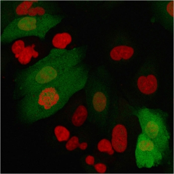 Recombinant S100A4 Antibody / FSP1