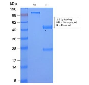 Serum Amyloid A Antibody / SAA1 + SAA2